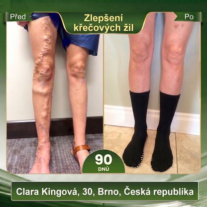 Oficiální značkový obchod 👑 BLUESHOT® 🍇 2026 10 v 1: Moringa & Berberin – Mikročásticové tvarující ponožky Spalujte tuky, tvarujte postavu, podpořte krevní oběh a metabolismus, uvolněte lymfatické uzliny. Výsledky uvidíte za 7 dní.