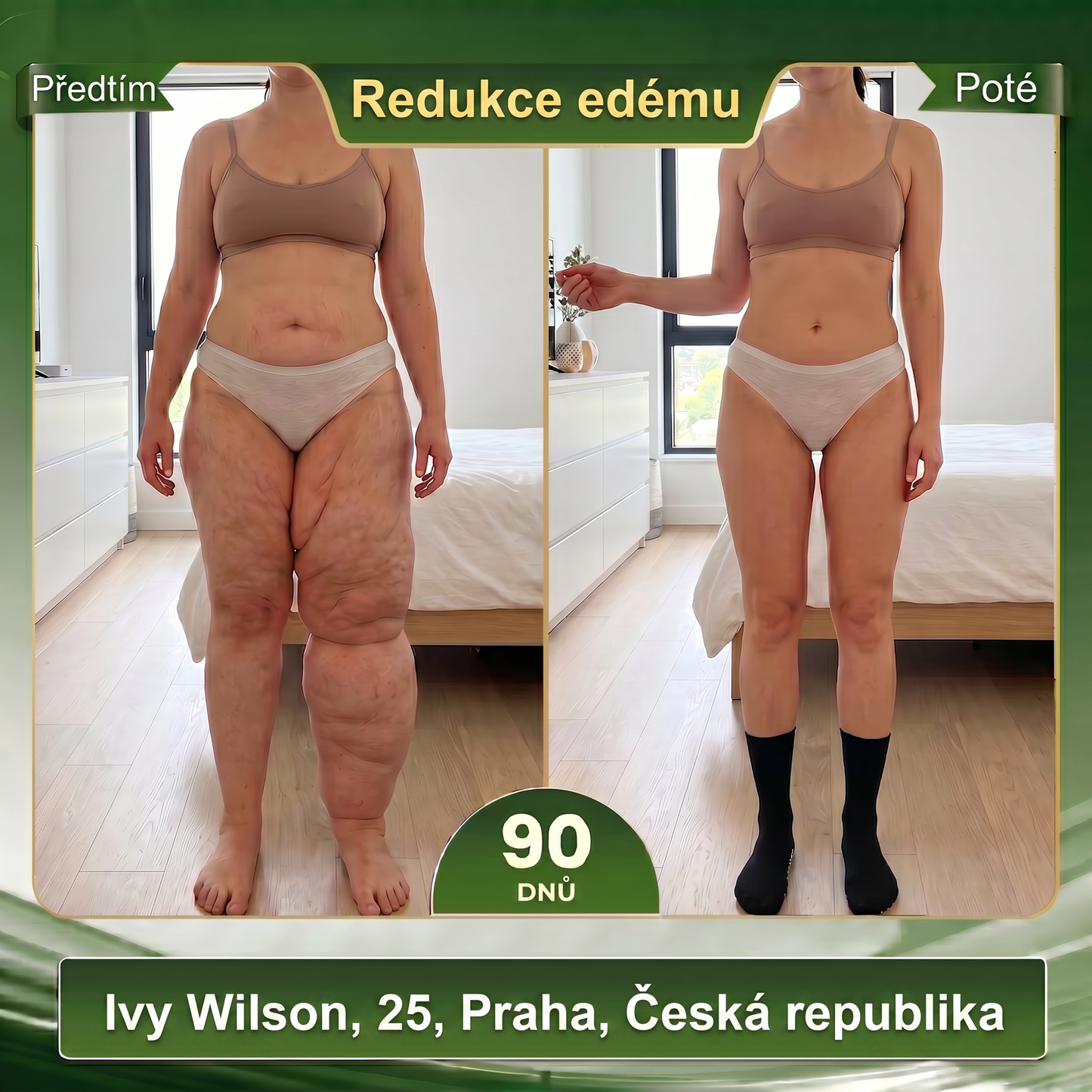 Oficiální značkový obchod 👑 BLUESHOT® 🍇 2026 10 v 1: Moringa & Berberin – Mikročásticové tvarující ponožky Spalujte tuky, tvarujte postavu, podpořte krevní oběh a metabolismus, uvolněte lymfatické uzliny. Výsledky uvidíte za 7 dní.