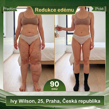 Oficiální značkový obchod 👑 BLUESHOT® 🍇 2026 10 v 1: Moringa & Berberin – Mikročásticové tvarující ponožky Spalujte tuky, tvarujte postavu, podpořte krevní oběh a metabolismus, uvolněte lymfatické uzliny. Výsledky uvidíte za 7 dní.