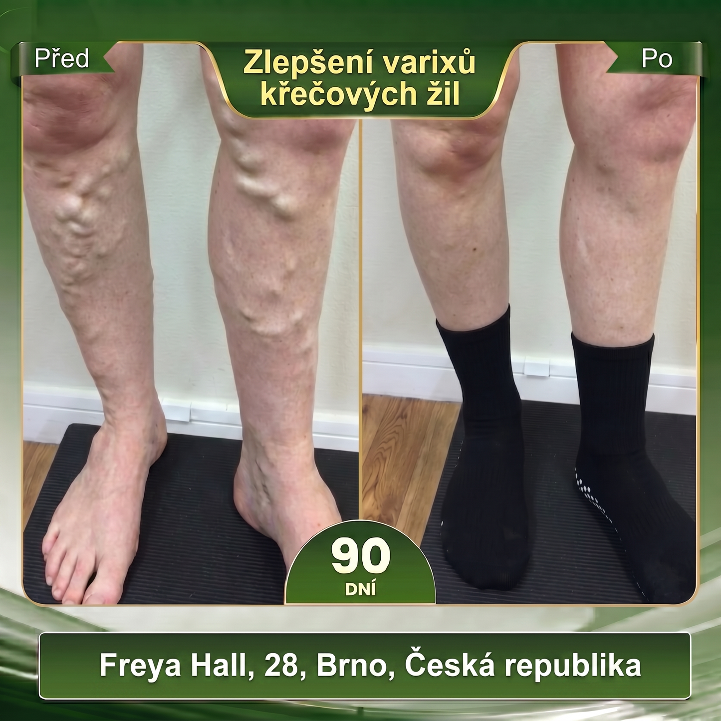 Oficiální značkový obchod 👑 BLUESHOT® 🍇 2026 10 v 1: Moringa & Berberin – Mikročásticové tvarující ponožky Spalujte tuky, tvarujte postavu, podpořte krevní oběh a metabolismus, uvolněte lymfatické uzliny. Výsledky uvidíte za 7 dní.