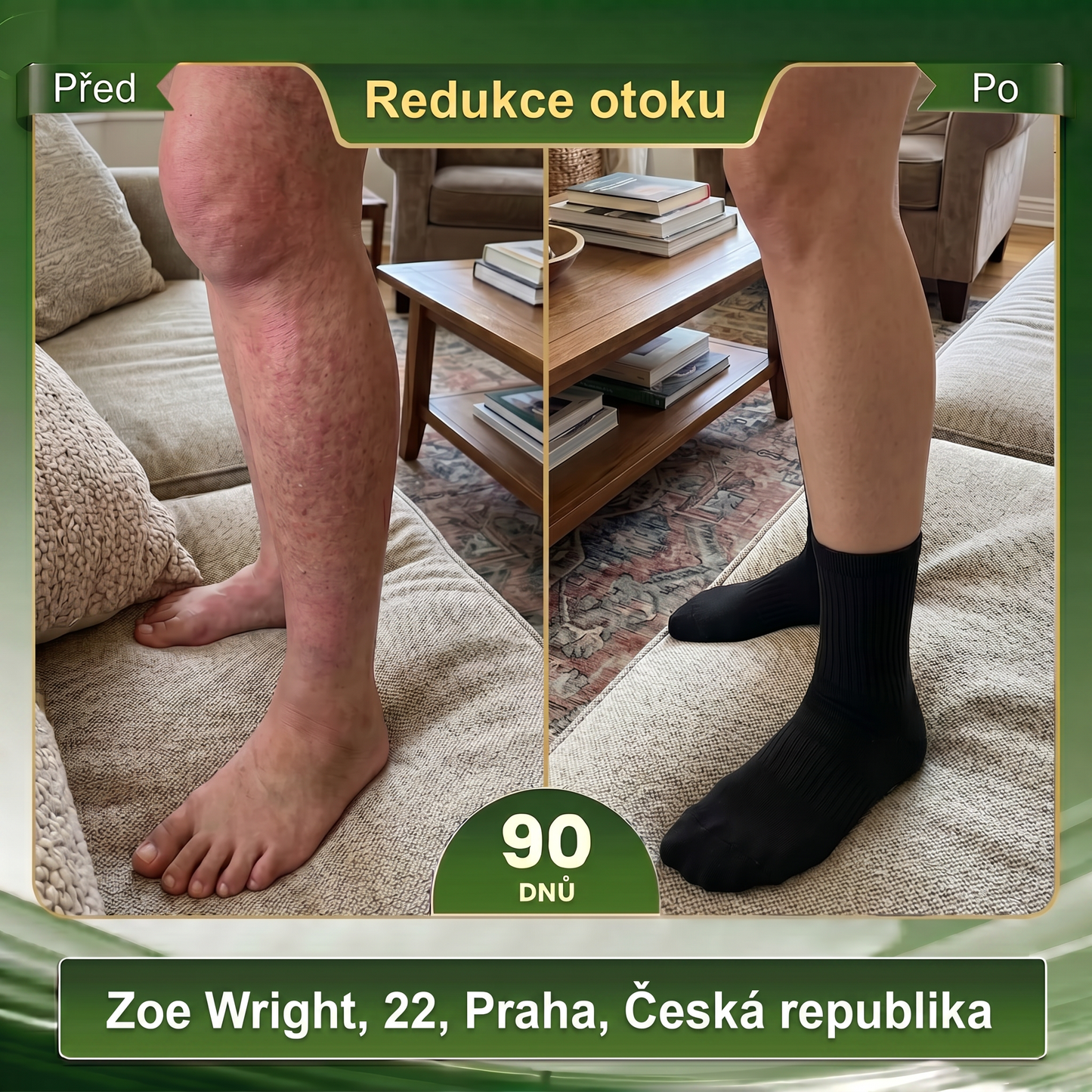 Oficiální značkový obchod 👑 BLUESHOT® 🍇 2026 10 v 1: Moringa & Berberin – Mikročásticové tvarující ponožky Spalujte tuky, tvarujte postavu, podpořte krevní oběh a metabolismus, uvolněte lymfatické uzliny. Výsledky uvidíte za 7 dní.